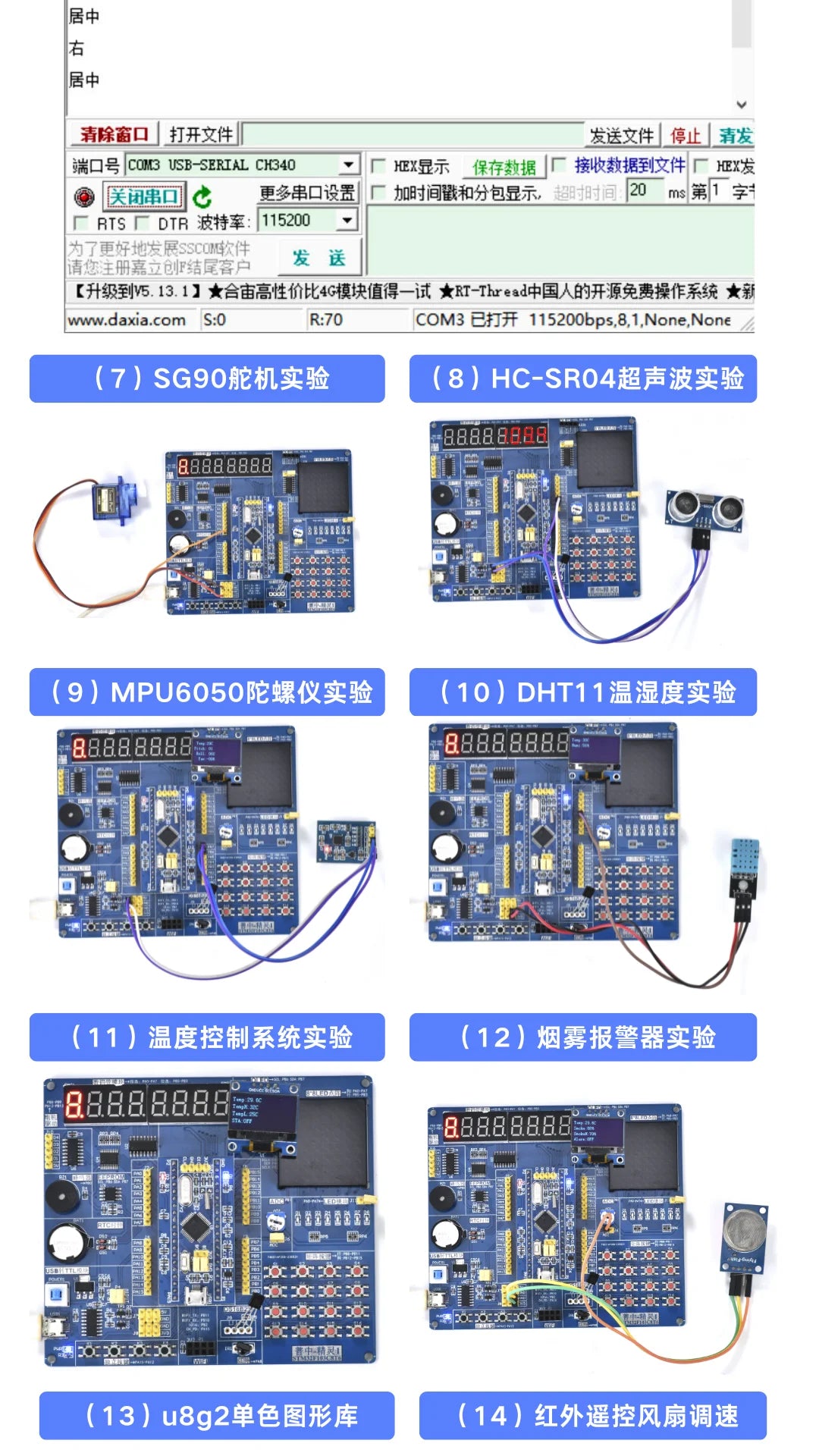 STM32 Development Board Beginner Learning Kit STM32 Microcontroller Small System Board