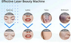 1064/532/1032nm Laser Picosecond Handle ND YAG The Beauty Instrument Accessory for Removing Melanin,Tattoos Cleaning Eyebrows