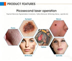 Laser handle 755nm/532nm/1064nm/1320nm Nd:YAG Picosecond Laser Pigment Pico Skin Rejuvenation Machine Handle